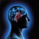 CyberKnife – nowoczesna radioterapia