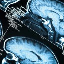 Endoskopowa chirurgia  podstawy czaszki