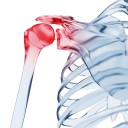 Scyntygrafia układu kostnego